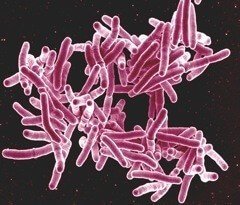 Анализ на туберкулез 