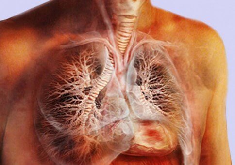 Кавернозный туберкулез легких: как развивается и чем лечить?