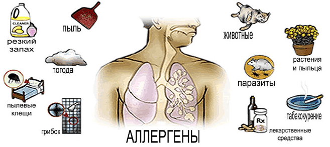 Аллергическая бронхиальная астма
