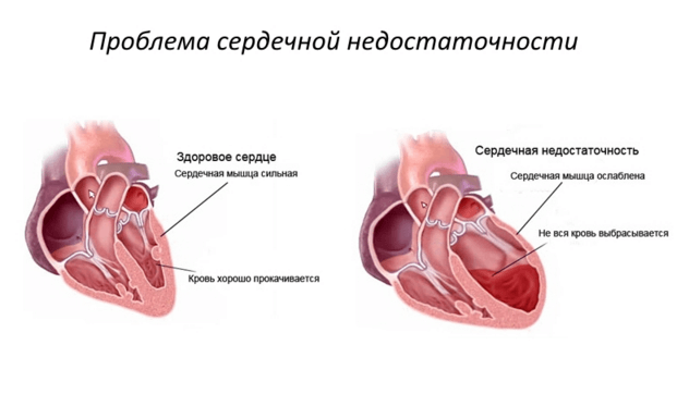 Патологии сердечно-сосудистой системы