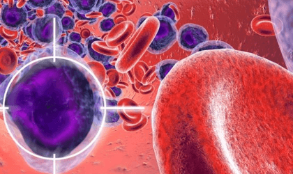 Лимфобластный лейкоз: причины развития и методы терапии
