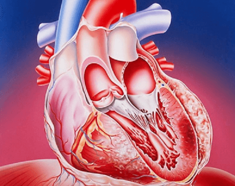 Абдоминальная форма инфаркта миокарда