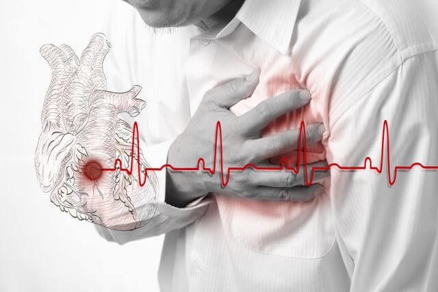 Последствия инфаркта миокарда: чего стоит бояться?