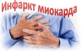 Признаки инфаркта миокарда по ЭКГ